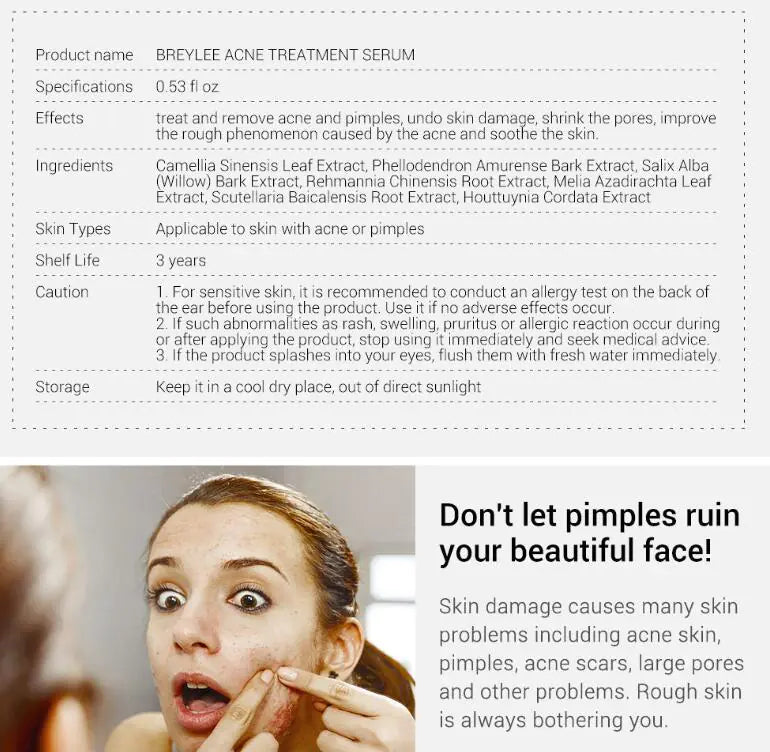 Esencia Reparadora Facial – Acne Treatment