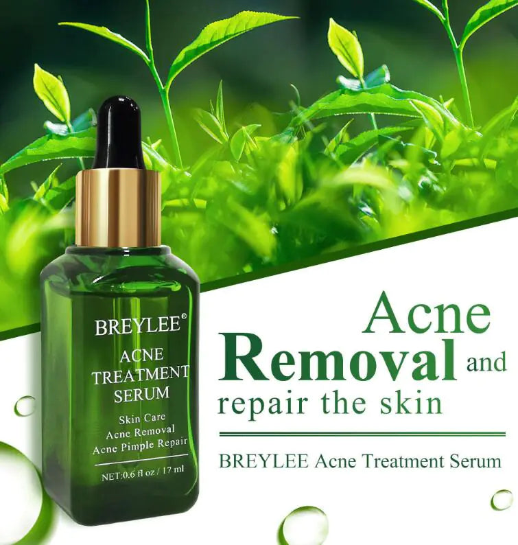 Esencia Reparadora Facial – Acne Treatment