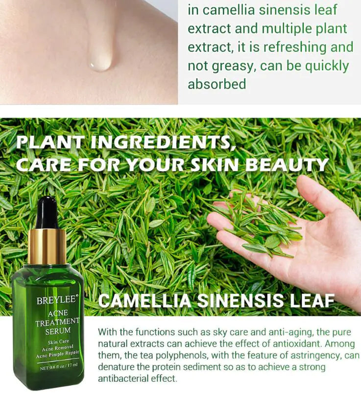Esencia Reparadora Facial – Acne Treatment